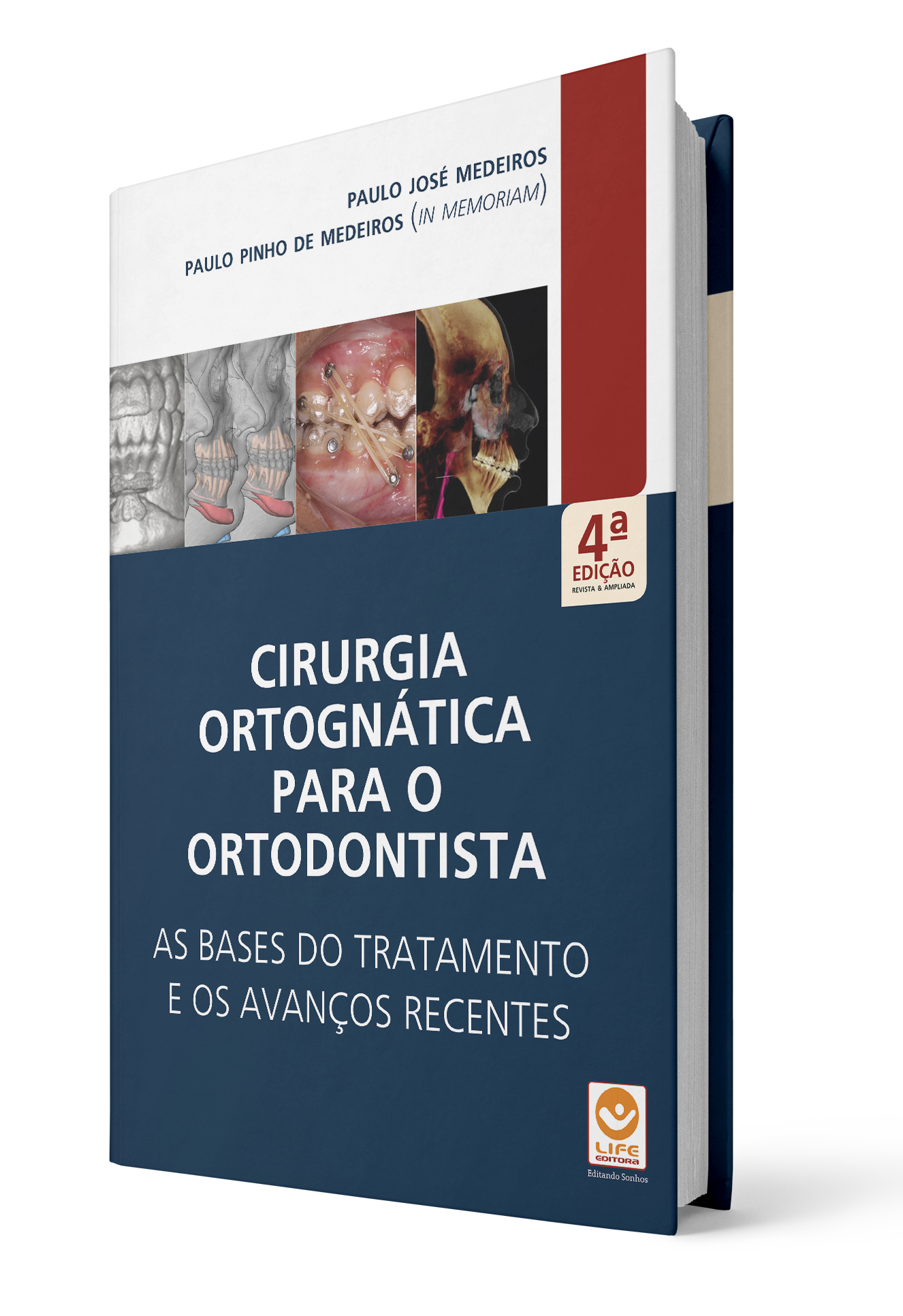 Livro Cirurgia Ortognática para o Ortodontista – As Bases do Tratamento e os Avanços Recentes